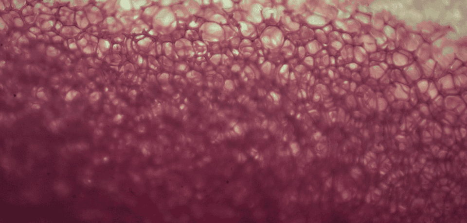 Mammogram-1200x630-2